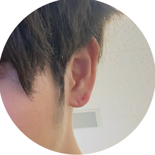 ピアスのあと